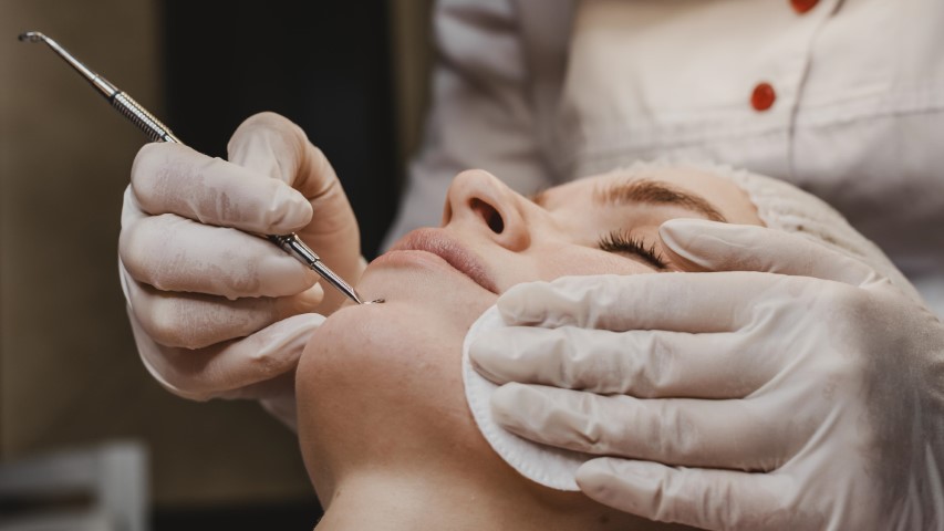 Efficacy and Safety of Microneedle Fractional Radiofrequency Combined with Botulinum Toxin Type A for Periorbital Aging: A Retrospective Cohort Study