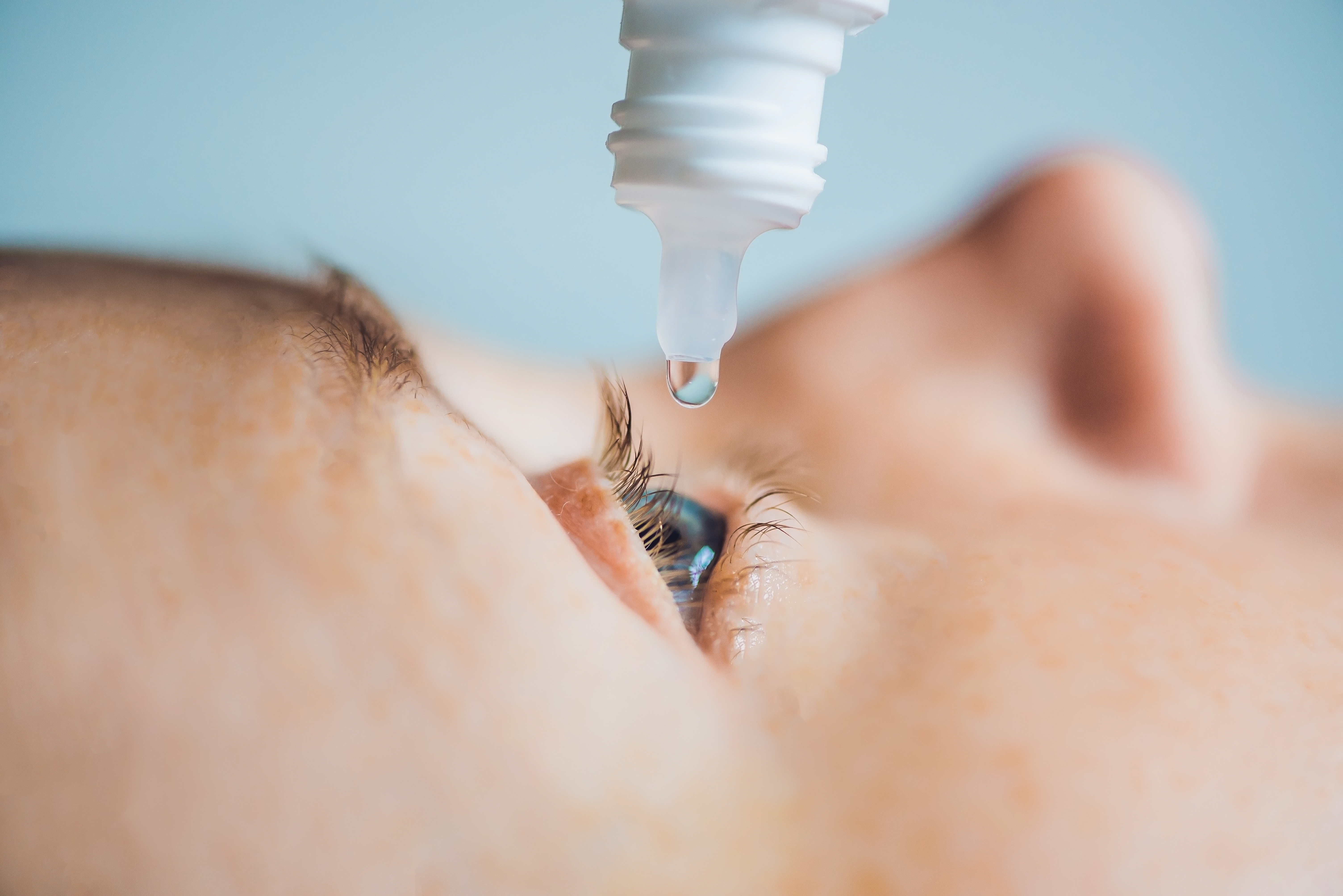 Look-Alike Packaging Causing Eye Injury: A Case of Scalp Lotion Misuse