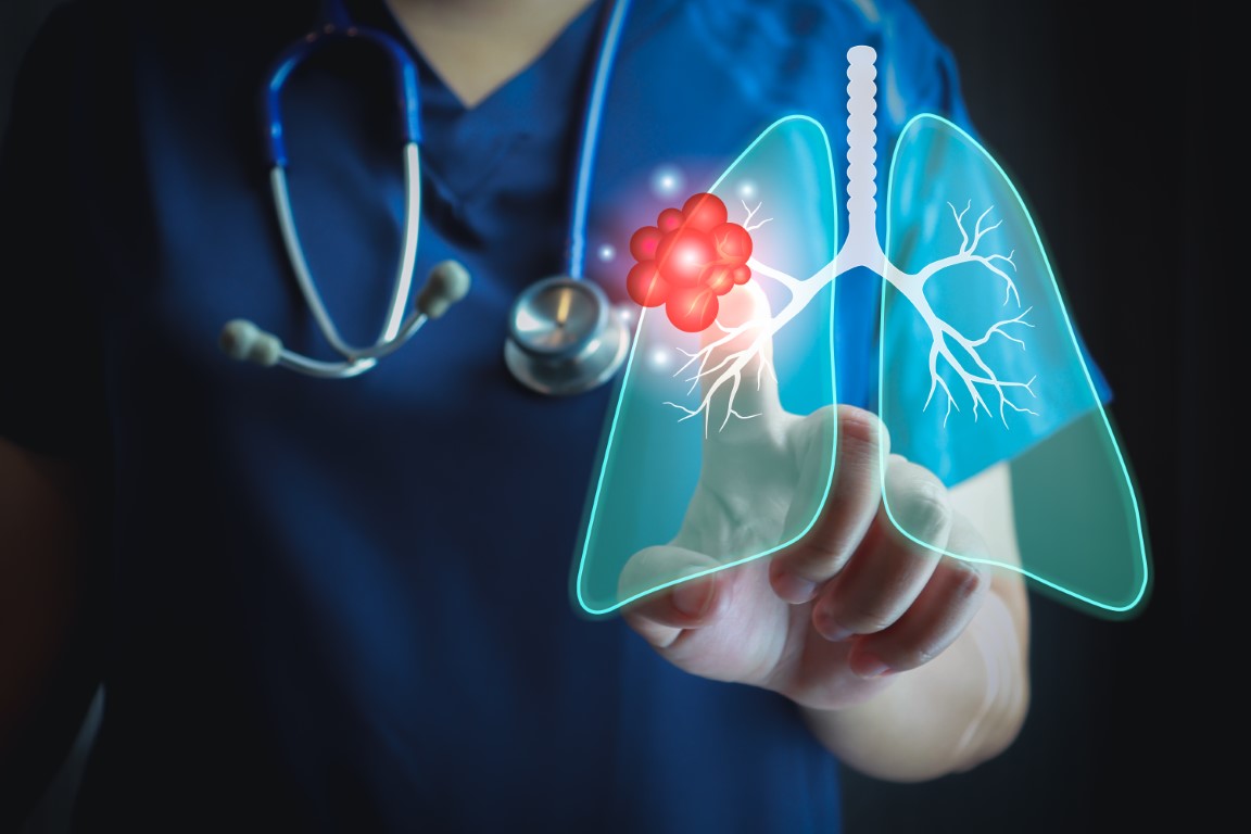 Red Cell Distribution Width Predicts Mortality in Critically Ill Patients with COPD and Atrial Fibrillation: A Retrospective Cohort Study