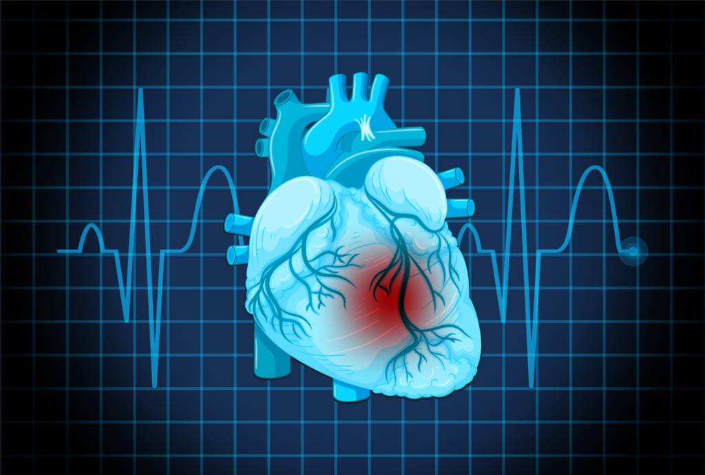 Elevated CVHI Linked to Lower Carotid Intima-Media Thickness: AHA