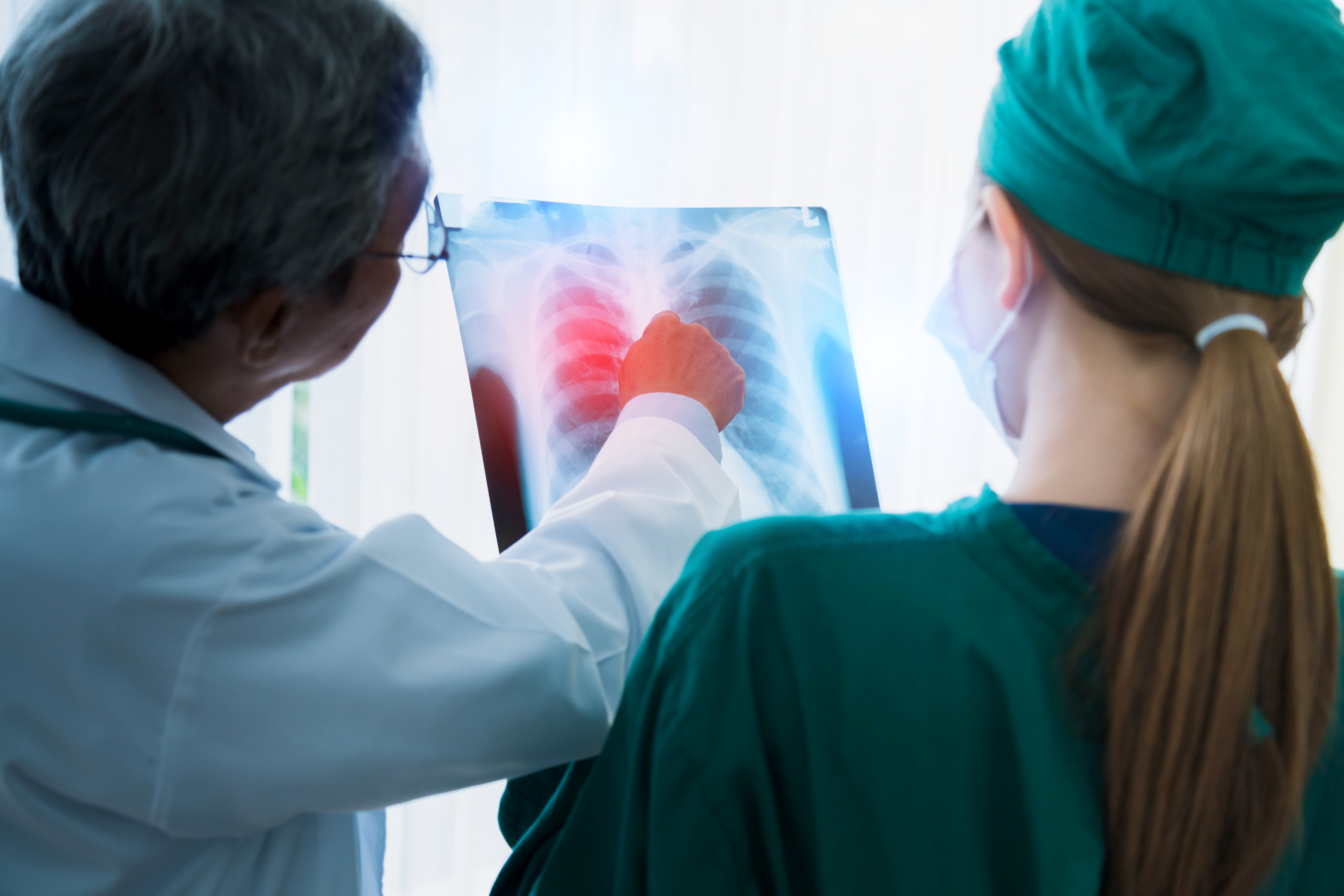 A 76-Year-Old Woman with Bilateral Pleural Effusion