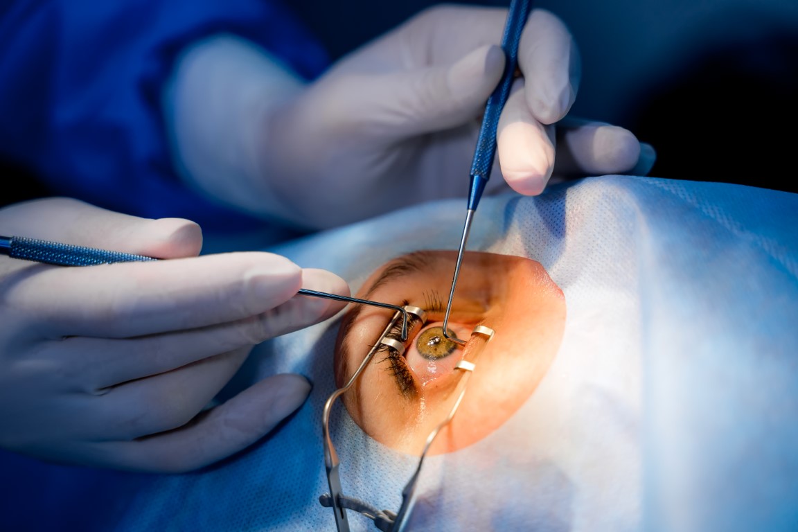 Delayed Spontaneous Closure of Macular Holes After Failed Surgery: A Scoping Review of Clinical Outcomes and Predictors